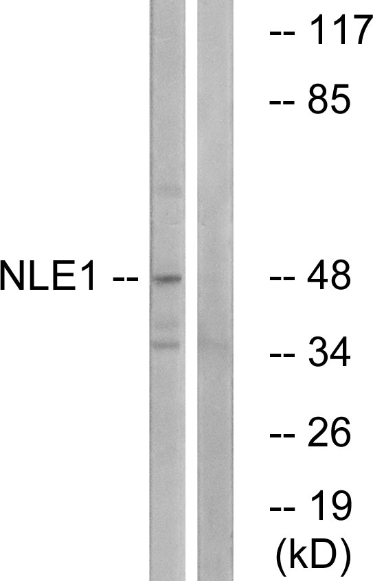 NLE1 Antibody - Western blot analysis of lysates from COS cells, using NLE1 Antibody. The lane on the right is blocked with the synthesized peptide.