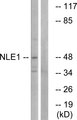 NLE1 Antibody - Western blot analysis of lysates from COS cells, using NLE1 Antibody. The lane on the right is blocked with the synthesized peptide.