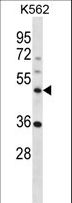 NLE1 Antibody - NLE1 Antibody western blot of K562 cell line lysates (35 ug/lane). The NLE1 antibody detected the NLE1 protein (arrow).