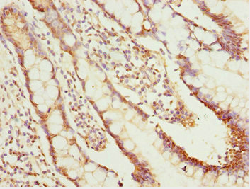 NLE1 Antibody - Immunohistochemistry of paraffin-embedded human small intestine tissue at dilution 1:100