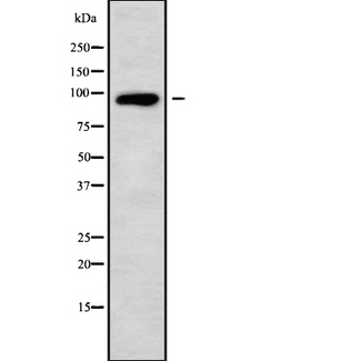 NLGN1 / Neuroligin 1 Antibody - Western blot analysis NLGN1 using HT29 whole cells lysates