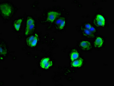 NLGN1 / Neuroligin 1 Antibody - Immunofluorescent analysis of MCF-7 cells diluted at 1:100 and Alexa Fluor 488-congugated AffiniPure Goat Anti-Rabbit IgG(H+L)
