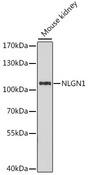 NLGN1 / Neuroligin 1 Antibody - Western blot analysis of extracts of mouse kidney using NLGN1 Polyclonal Antibody at dilution of 1:1000.