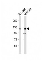 NLGN3 / Neuroligin 3 Antibody - All lanes : Anti-NLGN3 Antibody at 1:1000 dilution Lane 1: rat brain lysates Lane 2: mouse brain lysates Lysates/proteins at 20 ug per lane. Secondary Goat Anti-Rabbit IgG, (H+L), Peroxidase conjugated at 1/10000 dilution Predicted band size : 94 kDa Blocking/Dilution buffer: 5% NFDM/TBST.