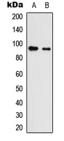 NLGN3 / Neuroligin 3 Antibody - Western blot analysis of Neuroligin 3 expression in HEK293T (A); NS-1 (B) whole cell lysates.