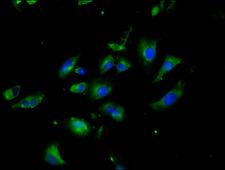 NLGN3 / Neuroligin 3 Antibody - Immunofluorescence staining of U251 cells at a dilution of 1:200, counter-stained with DAPI. The cells were fixed in 4% formaldehyde, permeabilized using 0.2% Triton X-100 and blocked in 10% normal Goat Serum. The cells were then incubated with the antibody overnight at 4 °C.The secondary antibody was Alexa Fluor 488-congugated AffiniPure Goat Anti-Rabbit IgG (H+L) .