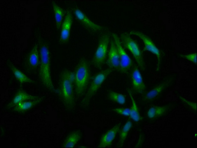 NLGN4X / KIAA1260 Antibody - Immunofluorescence staining of Hela cells at a dilution of 1:200, counter-stained with DAPI. The cells were fixed in 4% formaldehyde, permeabilized using 0.2% Triton X-100 and blocked in 10% normal Goat Serum. The cells were then incubated with the antibody overnight at 4 °C.The secondary antibody was Alexa Fluor 488-congugated AffiniPure Goat Anti-Rabbit IgG (H+L) .