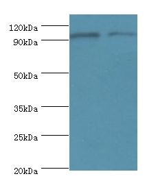 NLGN4Y Antibody - Western blot. All lanes: NLGN4Y antibody at 6 ug/ml. Lane 1: A549 whole cell lysate. Lane 2: mouse brain tissue. Secondary antibody: Goat polyclonal to rabbit at 1:10000 dilution. Predicted band size: 92 kDa. Observed band size: 92 kDa Immunohistochemistry.