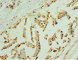 NLGN4Y Antibody - Immunohistochemistry of paraffin-embedded human prostate using antibody at 1:100 dilution.
