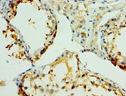 NLGN4Y Antibody - Immunohistochemistry of paraffin-embedded human placenta using antibody at 1:100 dilution.