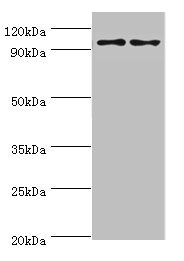 NLGN4Y Antibody - Western blot All lanes: NLGN4Y antibody at 6µg/ml Lane 1: A549 whole cell lysate Lane 2: Mouse brain tissue Secondary Goat polyclonal to rabbit IgG at 1/10000 dilution Predicted band size: 93, 73, 16, 29 kDa Observed band size: 93 kDa
