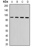 NLGN4Y Antibody - Western blot analysis of Neuroligin Y expression in HeLa (A); A549 (B); mouse brain (C); rat brain (D) whole cell lysates.