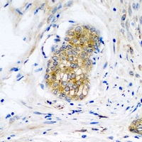 NLGN4Y Antibody - Immunohistochemical analysis of Neuroligin Y staining in human prostate formalin fixed paraffin embedded tissue section. The section was pre-treated using heat mediated antigen retrieval with sodium citrate buffer (pH 6.0). The section was then incubated with the antibody at room temperature and detected using an HRP conjugated compact polymer system. DAB was used as the chromogen. The section was then counterstained with hematoxylin and mounted with DPX.