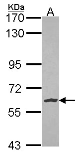 NLK Antibody - Sample (30 ug of whole cell lysate). A: Hela. 7.5% SDS PAGE. NLK antibody. NLK antibody diluted at 1:1000.
