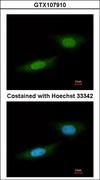 NLK Antibody - Immunofluorescence of paraformaldehyde-fixed HeLa using NLK antibody at 1:100 dilution.