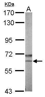 NLK Antibody - Sample (50 ug of whole cell lysate). A: Mouse brain. 7.5% SDS PAGE. NLK antibody diluted at 1:1000.
