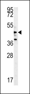 NLK Antibody - NLK-T286 western blot of Y79 cell line lysates (35 ug/lane). The NLK antibody detected the NLK protein (arrow).