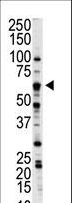 NLK Antibody - Western blot of anti-NLK antibody in A375 cell lysate. NLK (arrow) was detected using purified antibody. Secondary HRP-anti-rabbit was used for signal visualization with chemiluminescence.