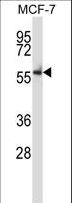 NLK Antibody - Mouse Nlk Antibody western blot of MCF-7 cell line lysates (35 ug/lane). The Nlk antibody detected the Nlk protein (arrow).