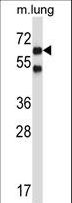 NLK Antibody - Mouse Nlk Antibody western blot of mouse lung tissue lysates (35 ug/lane). The Nlk antibody detected the Nlk protein (arrow).