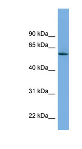 NLK Antibody - NLK antibody Western blot of 293T cell lysate. This image was taken for the unconjugated form of this product. Other forms have not been tested.