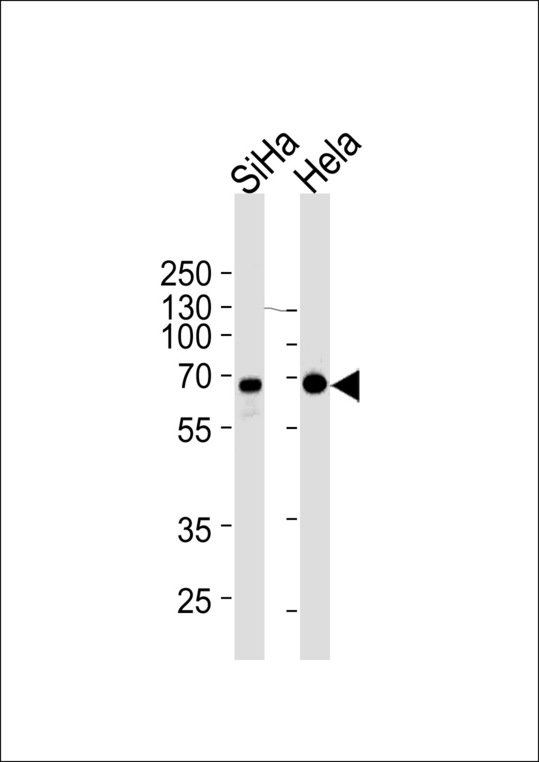 NLK Antibody - NLK Antibody western blot of SiHa,HeLa cell line lysates (35 ug/lane). The NLK antibody detected the NLK protein (arrow).