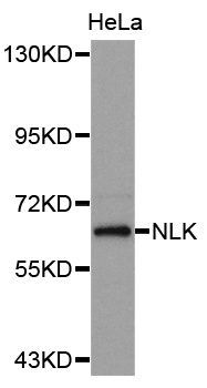 NLK Antibody - Western blot analysis of extracts of HeLa cells.