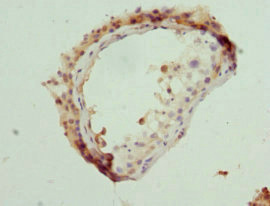 NLK Antibody - Immunohistochemistry of paraffin-embedded human testis at dilution 1:100