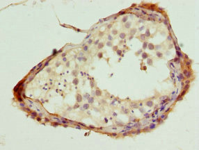 NLK Antibody - Immunohistochemistry of paraffin-embedded human testis at dilution 1:100