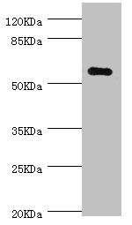 NLK Antibody - Western blot All Lanes:NLK antibody at 0.7ug/ml+MCF-7 whole cell lysate Secondary Goat polyclonal to rabbit at 1/10000 dilution Predicted band size: 58kDa Observed band size: 58kDa