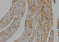 NLK Antibody - 1:100 staining mouse heart tissue by IHC-P. The sample was formaldehyde fixed and a heat mediated antigen retrieval step in citrate buffer was performed. The sample was then blocked and incubated with the antibody for 1.5 hours at 22°C. An HRP conjugated goat anti-rabbit antibody was used as the secondary.