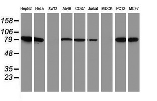 NLN / Neurolysin Antibody - Western blot of extracts (35 ug) from 9 different cell lines by using anti-NLN monoclonal antibody.