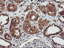 NLN / Neurolysin Antibody - IHC of paraffin-embedded Human Kidney tissue using anti-NLN mouse monoclonal antibody. (Heat-induced epitope retrieval by 10mM citric buffer, pH6.0, 100C for 10min).