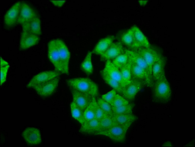 NLN / Neurolysin Antibody - Immunofluorescence staining of HepG2 cells diluted at 1:100, counter-stained with DAPI. The cells were fixed in 4% formaldehyde, permeabilized using 0.2% Triton X-100 and blocked in 10% normal Goat Serum. The cells were then incubated with the antibody overnight at 4°C.The Secondary antibody was Alexa Fluor 488-congugated AffiniPure Goat Anti-Rabbit IgG (H+L).
