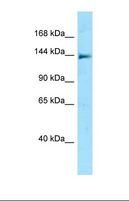 NLRC5 / NOD4 Antibody - Western blot of Human Jurkat . NLRC5 antibody dilution 1.0 ug/ml.  This image was taken for the unconjugated form of this product. Other forms have not been tested.