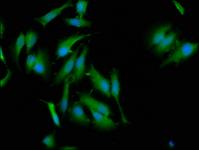 NLRC5 / NOD4 Antibody - Immunofluorescence staining of Hela cells at a dilution of 1:133, counter-stained with DAPI. The cells were fixed in 4% formaldehyde, permeabilized using 0.2% Triton X-100 and blocked in 10% normal Goat Serum. The cells were then incubated with the antibody overnight at 4 °C.The secondary antibody was Alexa Fluor 488-congugated AffiniPure Goat Anti-Rabbit IgG (H+L) .