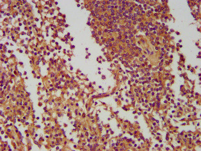 NLRC5 / NOD4 Antibody - Immunohistochemistry image at a dilution of 1:400 and staining in paraffin-embedded human spleen tissue performed on a Leica BondTM system. After dewaxing and hydration, antigen retrieval was mediated by high pressure in a citrate buffer (pH 6.0) . Section was blocked with 10% normal goat serum 30min at RT. Then primary antibody (1% BSA) was incubated at 4 °C overnight. The primary is detected by a biotinylated secondary antibody and visualized using an HRP conjugated SP system.