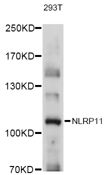 NLRP11 Antibody - Western blot analysis of extracts of 293T cells, using NLRP11 antibody at 1:1000 dilution. The secondary antibody used was an HRP Goat Anti-Rabbit IgG (H+L) at 1:10000 dilution. Lysates were loaded 25ug per lane and 3% nonfat dry milk in TBST was used for blocking. An ECL Kit was used for detection and the exposure time was 1s.