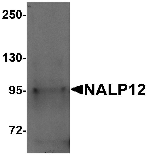 NLRP12 Antibody - Western blot analysis of NALP12 in human brain tissue lysate with NALP12 antibody at 1 ug/ml.