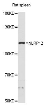 NLRP12 Antibody - Western blot analysis of extracts of rat spleen, using NLRP12 antibody at 1:3000 dilution. The secondary antibody used was an HRP Goat Anti-Rabbit IgG (H+L) at 1:10000 dilution. Lysates were loaded 25ug per lane and 3% nonfat dry milk in TBST was used for blocking. An ECL Kit was used for detection and the exposure time was 90s.