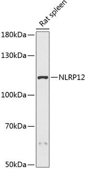 NLRP12 Antibody - Western blot analysis of extracts of rat spleen using NLRP12 Polyclonal Antibody at dilution of 1:3000.