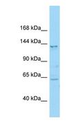 NLRP12 Antibody - Western blot of NLRP12 Antibody with human HeLa Whole Cell lysate.  This image was taken for the unconjugated form of this product. Other forms have not been tested.