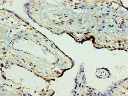 NLRP2 / NALP2 Antibody - Immunohistochemistry of paraffin-embedded human placenta using antibody at 1:100 dilution.
