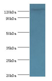 NLRP2 / NALP2 Antibody - Western blot. All lanes: NLRP2 antibody at 12 ug/ml+A431 whole cell lysate. Secondary antibody: Goat polyclonal to rabbit at 1:10000 dilution. Predicted band size: 121 kDa. Observed band size: 121 kDa Immunohistochemistry.