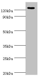 NLRP2 / NALP2 Antibody - Western blot All lanes: NLRP2 antibody at 12µg/ml + A431 whole cell lysate Secondary Goat polyclonal to rabbit IgG at 1/10000 dilution Predicted band size: 121, 119, 97, 118 kDa Observed band size: 121 kDa