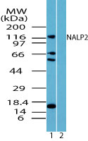 NLRP2 / NALP2 Antibody - Western blot of NALP2 in LNCAP cell lysate in the 1) absence and 2) presence of immunizing peptide using Peptide-affinity Purified Polyclonal Antibody to NALP2 at 0.25 ug/ml. Goat anti-rabbit Ig HRP secondary antibody, and PicoTect ECL substrate solution, were used for this test.