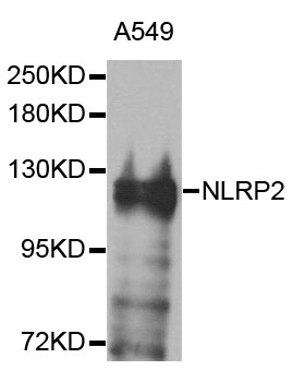NLRP2 / NALP2 Antibody - Western blot blot of extracts of A549 cells, using NLRP2 antibody.