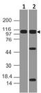 NLRP2 / NALP2 Antibody - Fig-1: Expression analysis of NALP2. Anti-NALP2 antibody was used at 0.5 µg/ml on (1) A431 and (2) K562 lysates.