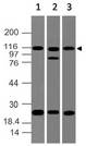 NLRP2 / NALP2 Antibody - Fig-1: Western blot analysis of NALP2. Anti-NALP2 antibody was used at 4 µg/ml on (1) h Testis, (2) HepG2, and (3) MCF-7 lysates.