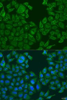 NLRP2 / NALP2 Antibody - Immunofluorescence analysis of U2OS cells using NLRP2 Polyclonal Antibody at dilution of 1:100.Blue: DAPI for nuclear staining.